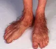 Feet.webp