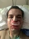 Nose.webp