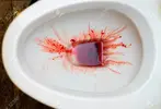 137764744-urine-is-red-blood-urine-in-flush-tank-in-the-bathroom-pee-mix-bloody.webp