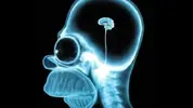 homer_brain_scan.webp