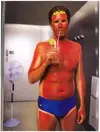 will-ferrell-sunburn.webp