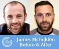 mcfadden_beforeafter.webp