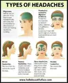 Headache chart.webp